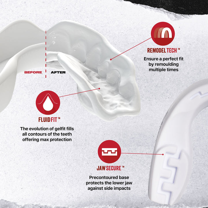 SAFEJAWZ INTRO MOUTHGUARD